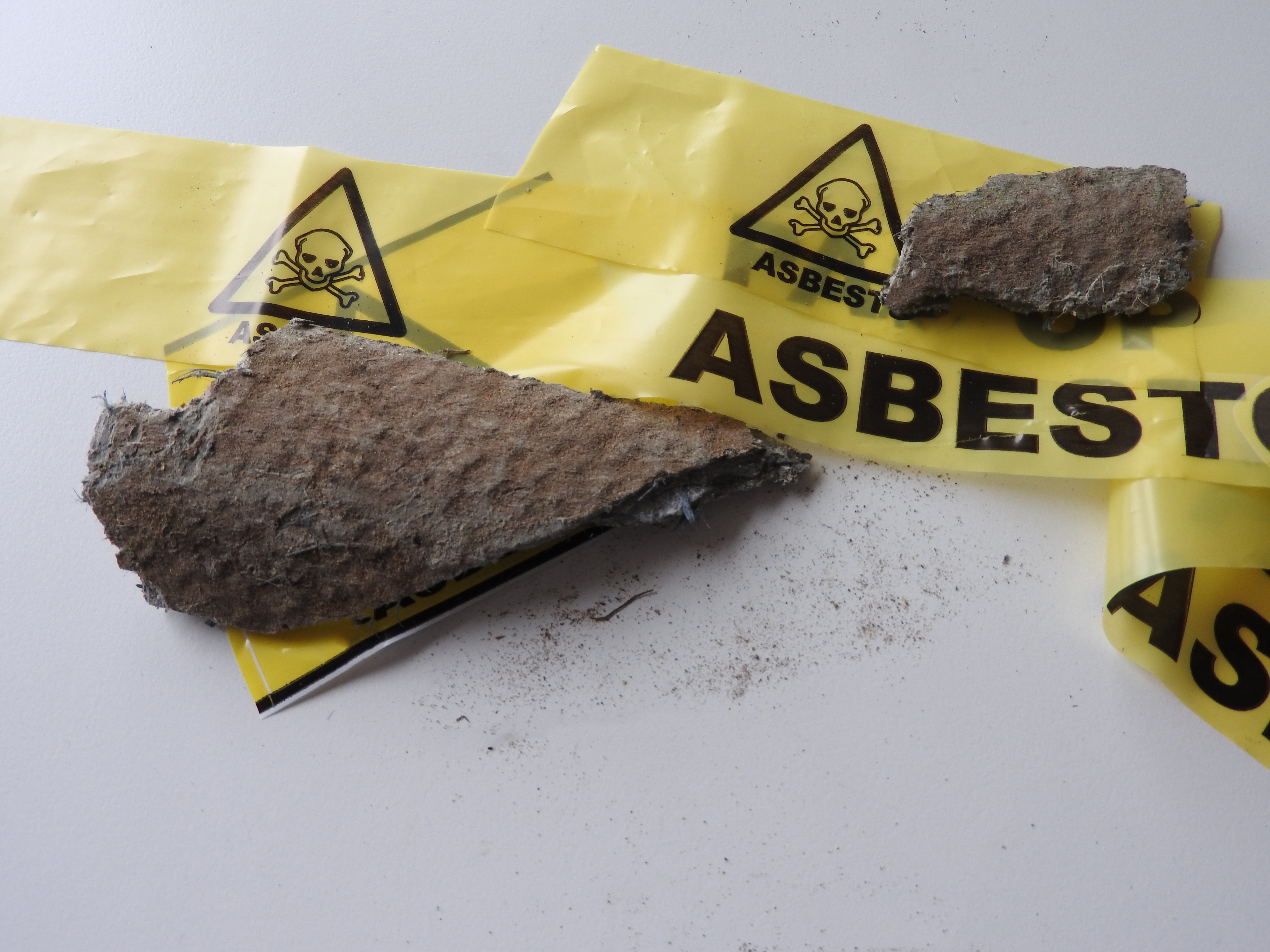 Begrijpen van Asbest Pleuraplaque 2